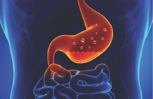 Remedy of the Month - Acidity