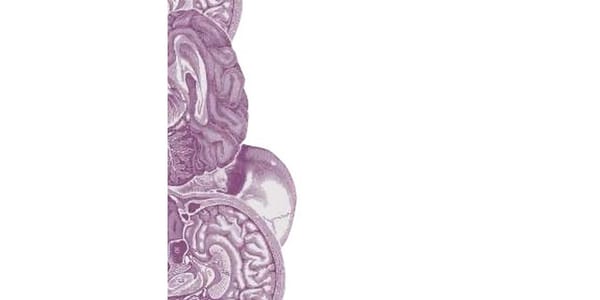 Remedies for Hormonal Imbalance